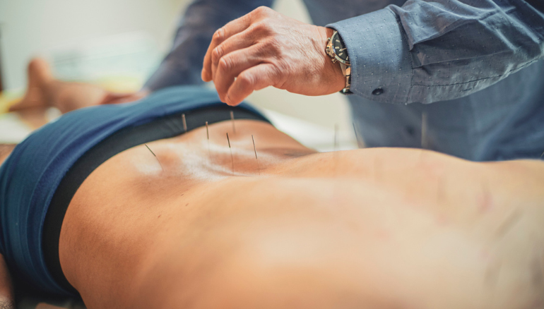 Ask the Expert: Does acupuncture help with male infertility?
