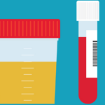 Ask the Expert: How do I get tested for sexually transmitted infections?